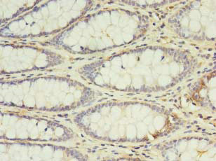 CSB-PA011629LA01HU IHC
